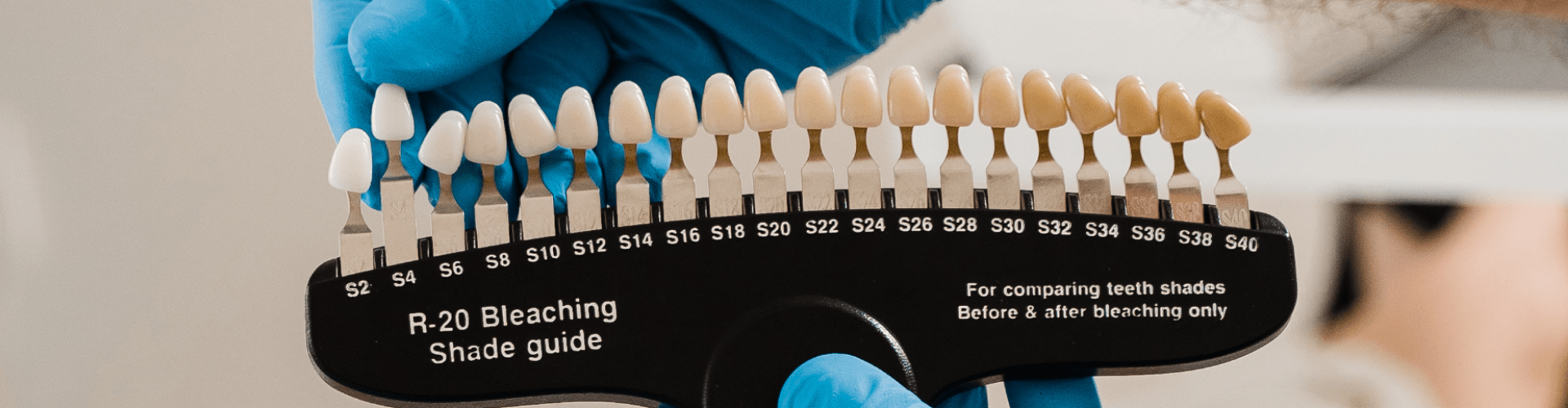 Gloved hands holding tooth shade-matching tool.